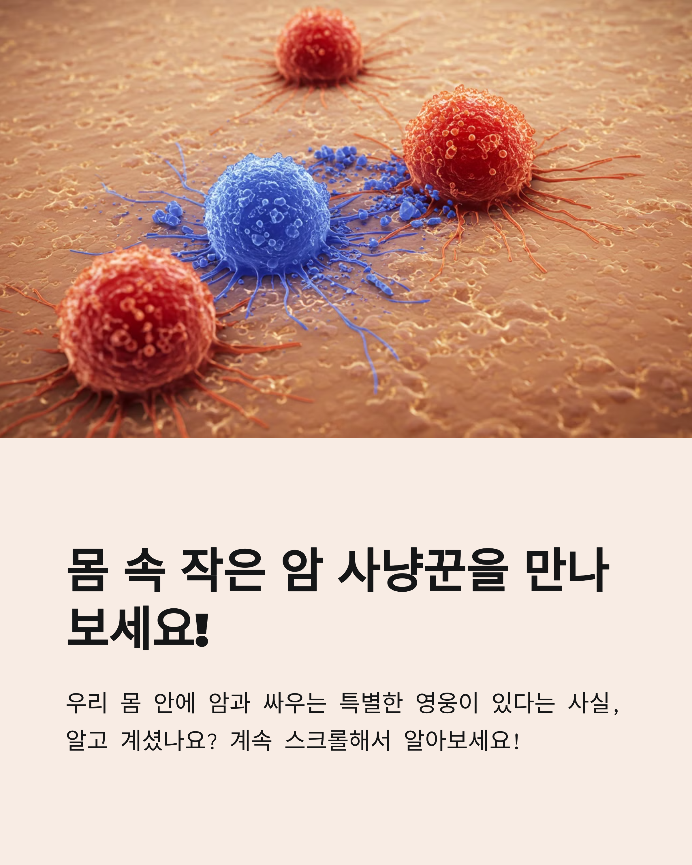 암사냥꾼nk세포