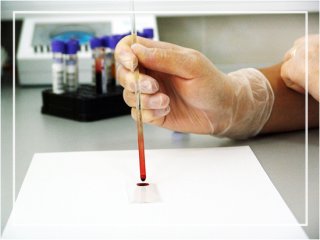 검진 전 금식 실수