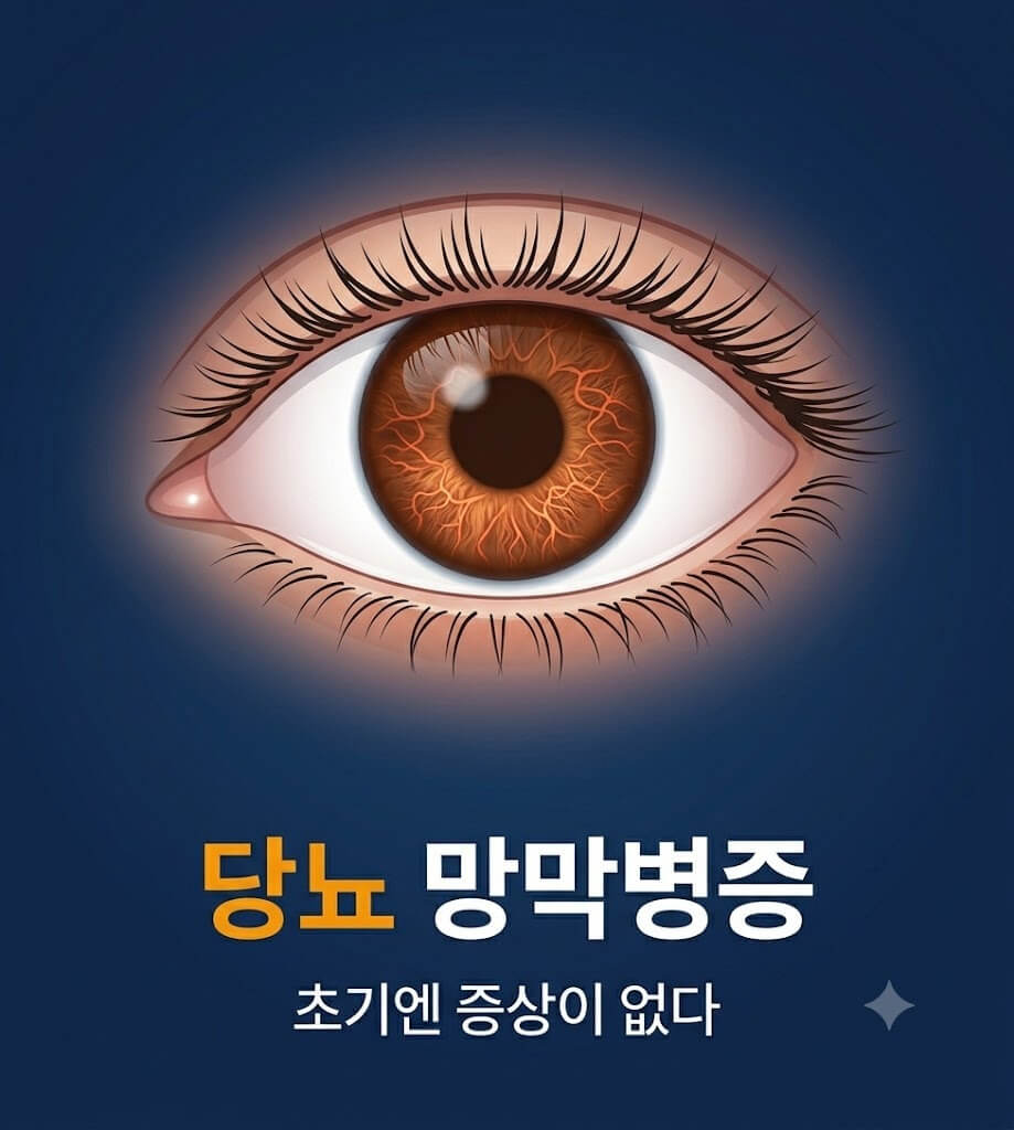 당뇨망박병증 초기엔 증상이 없이 보이는 인포그래픽