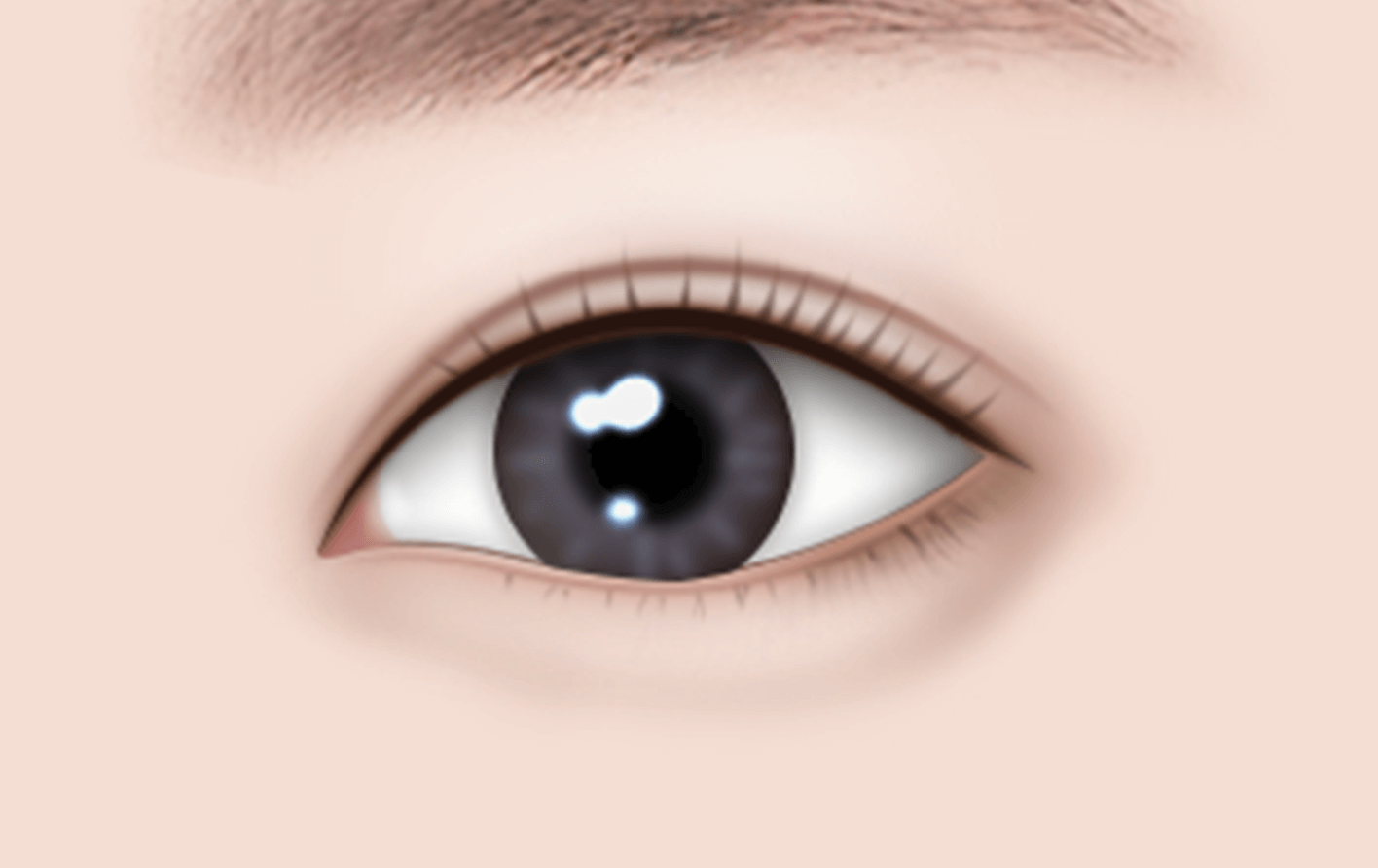 눈밑 필러 효과