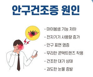 안구건조증 주요 원인