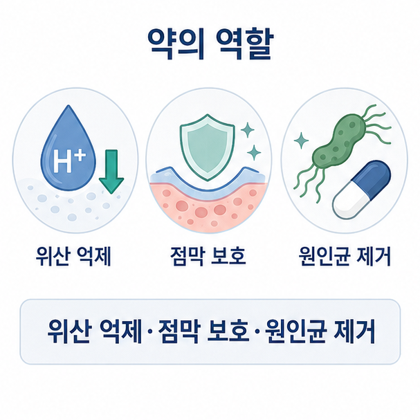위궤양 치료의 위산 억제와 점막 보호, 헬리코박터균 제거 역할을 설명한 이미지