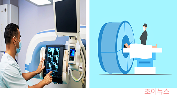간암 진단 방법 - MRI 검사