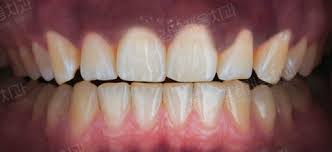 잇몸 염증 치료제 베스트 5