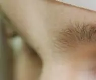 녹내장 초기 증상 &mdash; 시야를 서서히 빼앗는 침묵의 질환