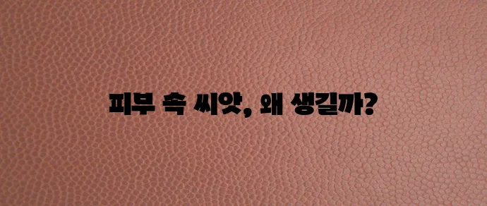 비립종 왜 생기는 걸까요 원인과 예방이 중요합니다.
