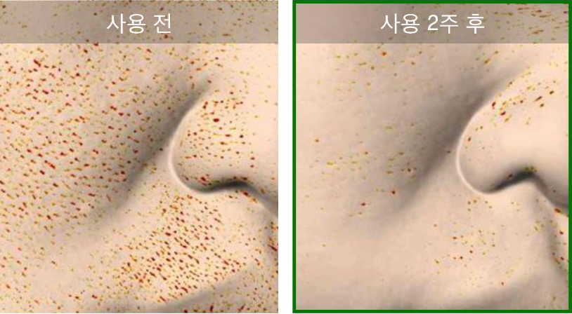 올리브영 스킨케어 TOP5