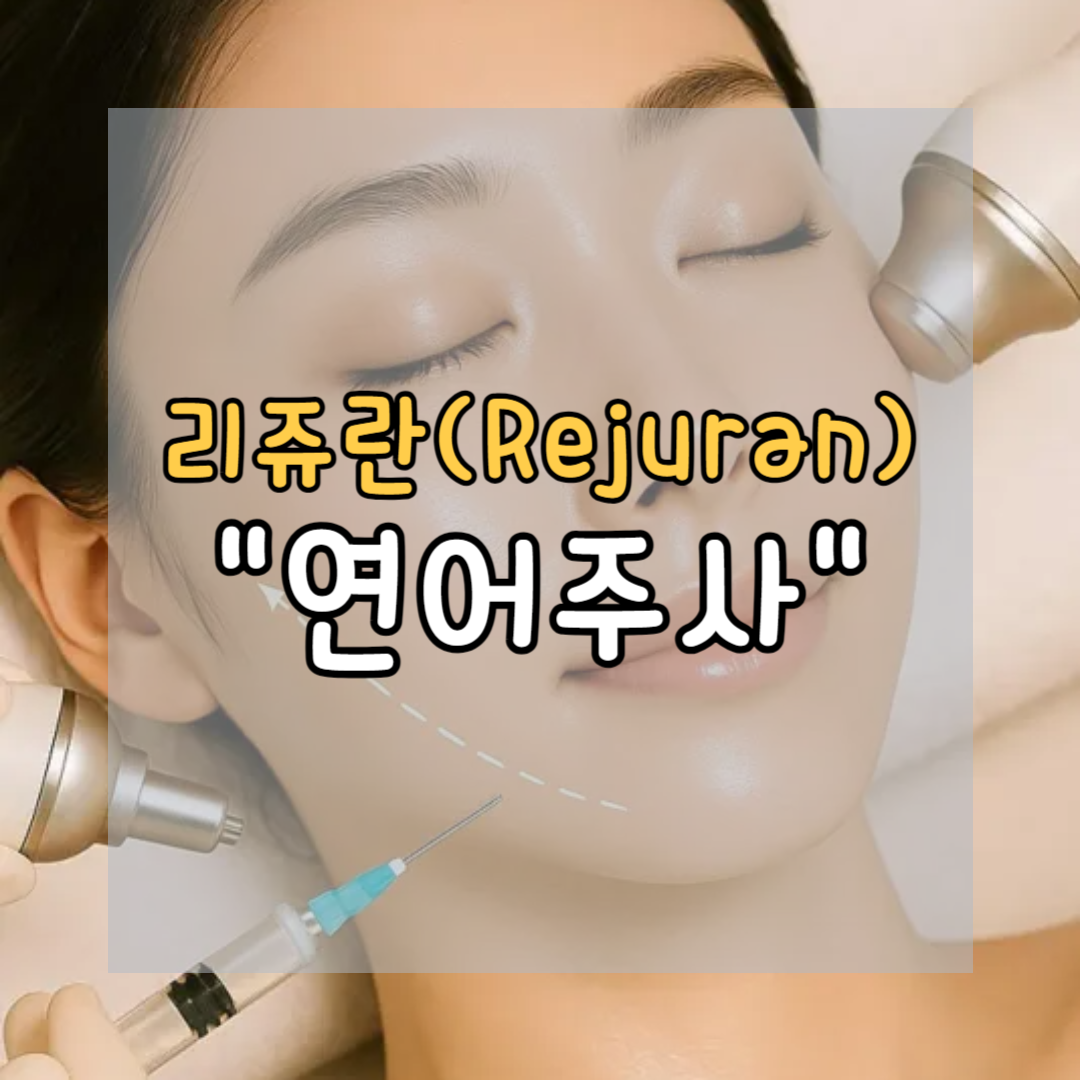 리쥬란 (연어주사) 종류별 특징