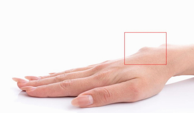 손목터널증후군 증상
