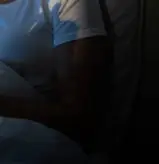 녹내장 초기 증상 &mdash; 시야를 서서히 빼앗는 침묵의 질환