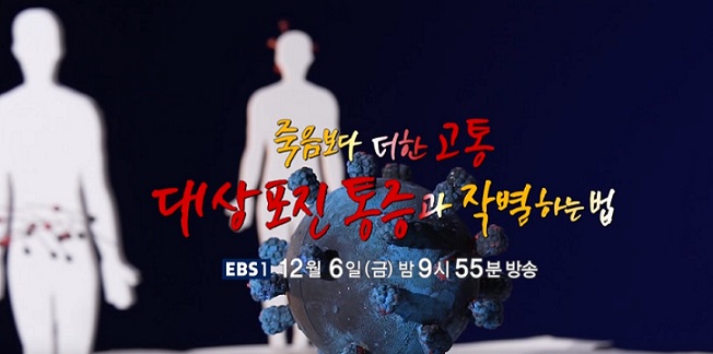 대상포진명의