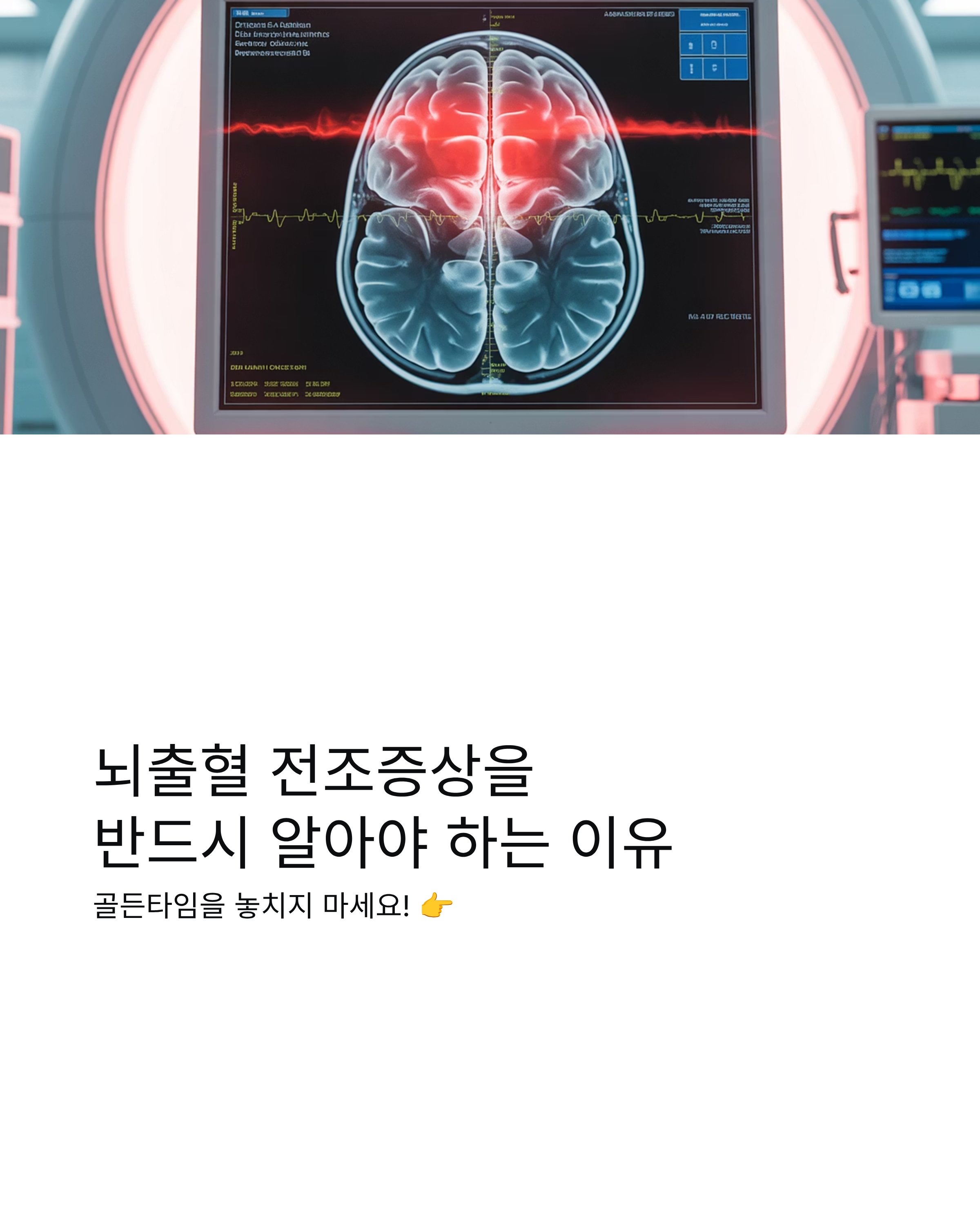 뇌출혈 전조증상 완벽 가이드 - 골든타임을 놓치지 마세요!