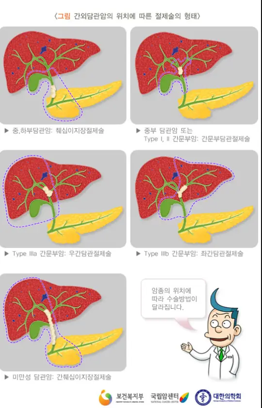 단도암-치료법