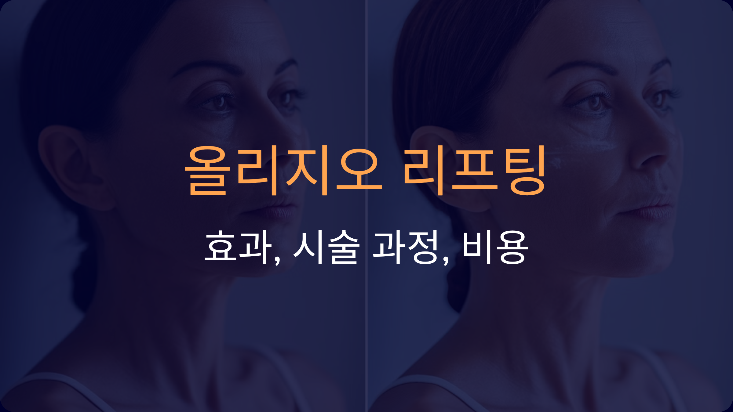 올리지오 리프팅: 효과, 시술 과정, 비용 및 비교 가이드