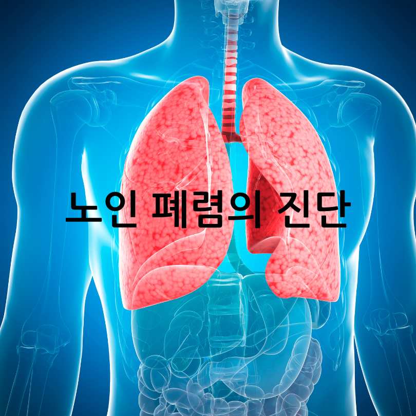 노인 폐렴 증상과 대처법