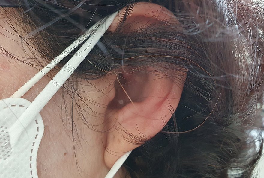 포낙보청기 귓속형 착용 고객님