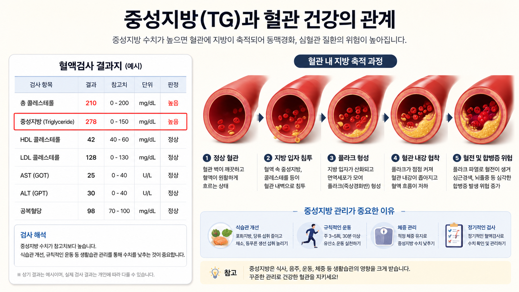 중성지방 수치 높을 때 원인별 생활습관 관리법 총정리