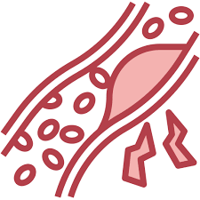 나쁜콜레스테롤 낮추는 방법