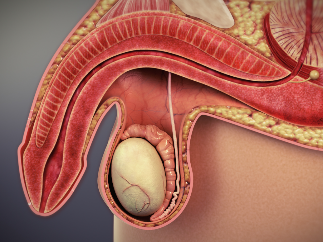 시알리스, 팔팔정, 무정자증 가능성 있다는 거 아시나요?