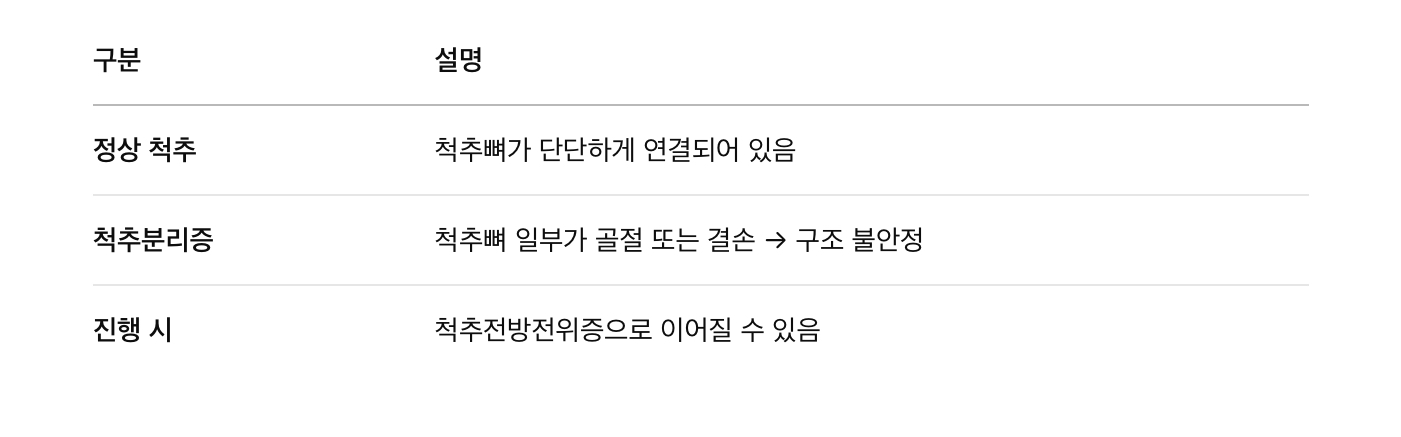 척추분리증이란