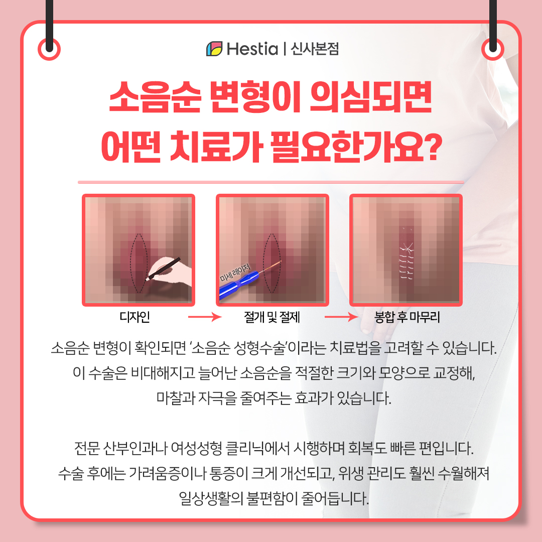 소음순 변형은 어떤 치료가 필요한가요?