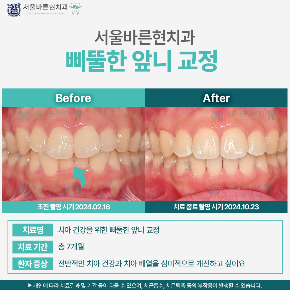 해운대교정치과