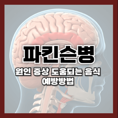 파킨슨병, 파킨슨병 초기증상, 파킨슨병 원인, 파킨슨병 예방법, 파킨슨병 좋은 음식, 파킨슨병 예방식단, 파킨슨병 생활습관, 파킨슨병 증상