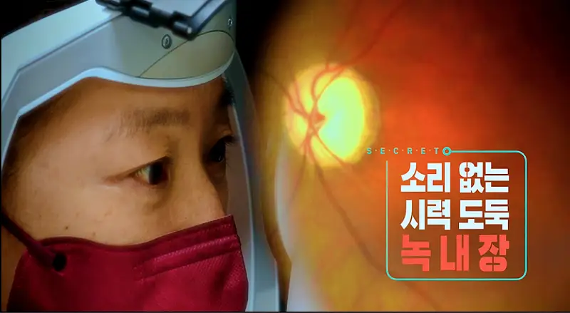 KBS 생로병사의 비밀 833회 높은 안압 녹내장 자각 증상 늦어 내 눈을 지킬 방법 오늘방송 다시보기 정보