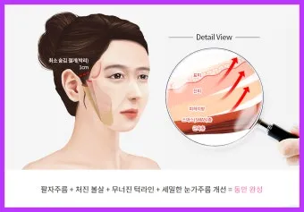 덴서티 리프팅 댄서티 가격 효과 유지기간에 관한 정보_14