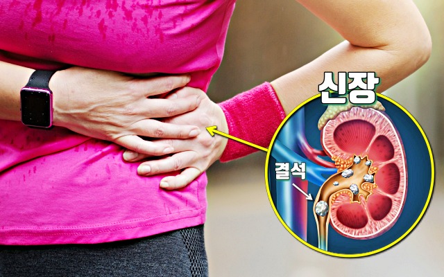 옆구리 통증,신장이 안좋을때 나타나는 증상 7가지
