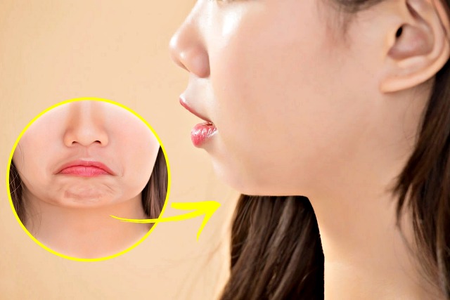 다이어트,턱살,턱밑살,이중턱,사각턱,턱선,턱밑이 붓는 이유,침샘 비대증,건강 팁줌