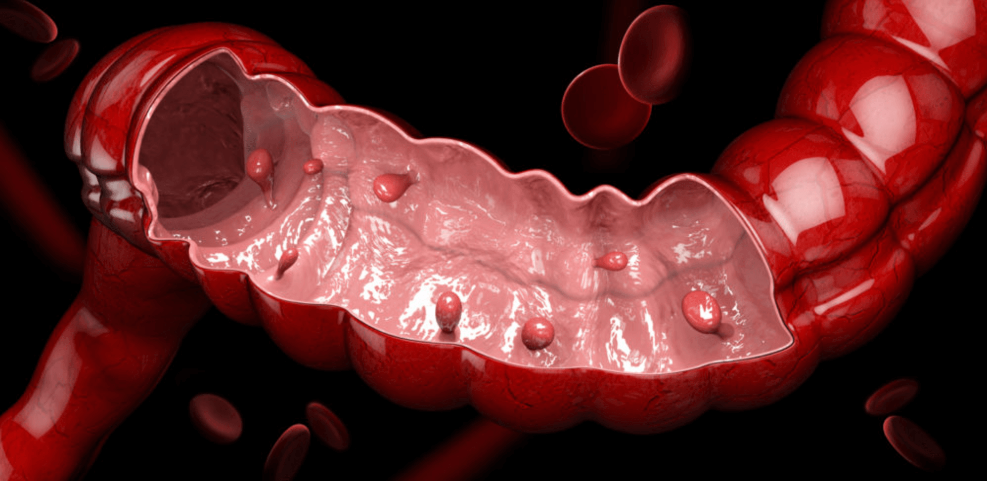 대장내시경-검사-5년마다