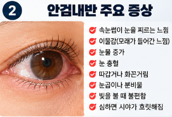 안검내반 속눈썹 눈 찌름