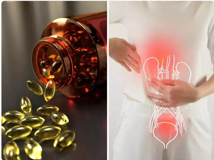 비타민 D 복용을 중지해야 하는 신호 Signs you should STOP taking Vitamin D supplements