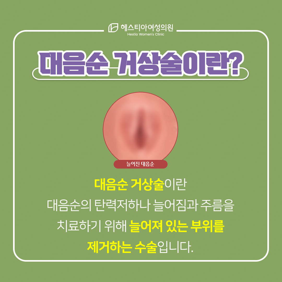 Y존부각
대음순늘어짐