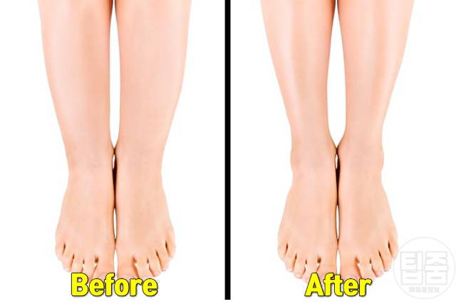 발목 얇아지는 법 발목 두꺼운 이유