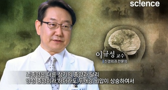 뇌종양명의