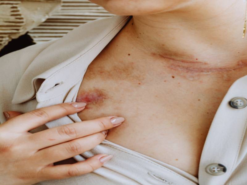 가려움증으로-피부를-긁는-사진