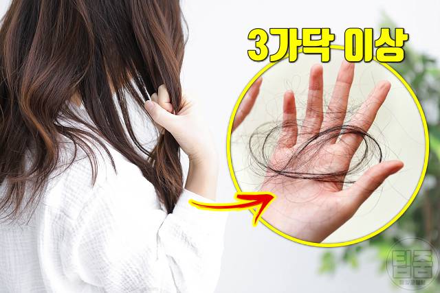 여자 탈모 자가진단 탈모초기증상 피부과학회