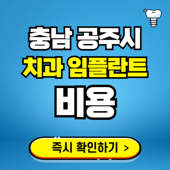 충남 공주시 임플란트 가격 비용 조회하기 ❘ 내 근처 저렴한 치과 찾기