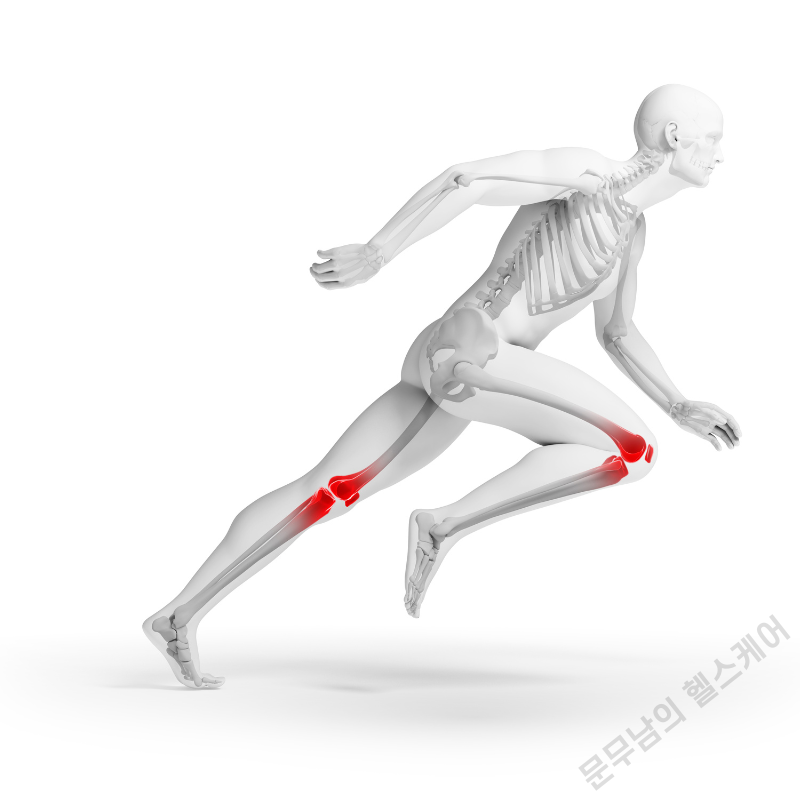 무릎에서 뚝뚝 소리나는 이유