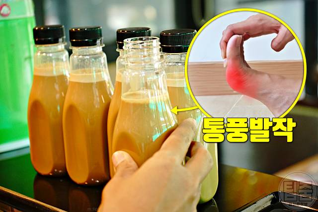 통풍에 좋은 음식 커피 통풍에 좋은 고기