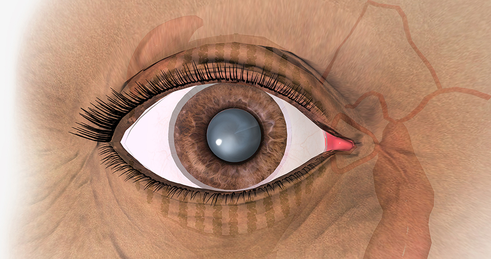 백내장 수술비용