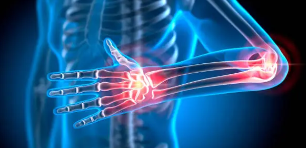 류머티스 관절염과 관련된 사진