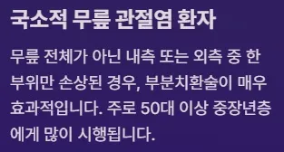 전방십자인대 보존형 무릎 부분치환술 - 국소적 무릎 관전염 환자에게 적합