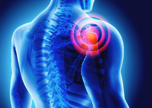 콘드로이친 효능 부작용