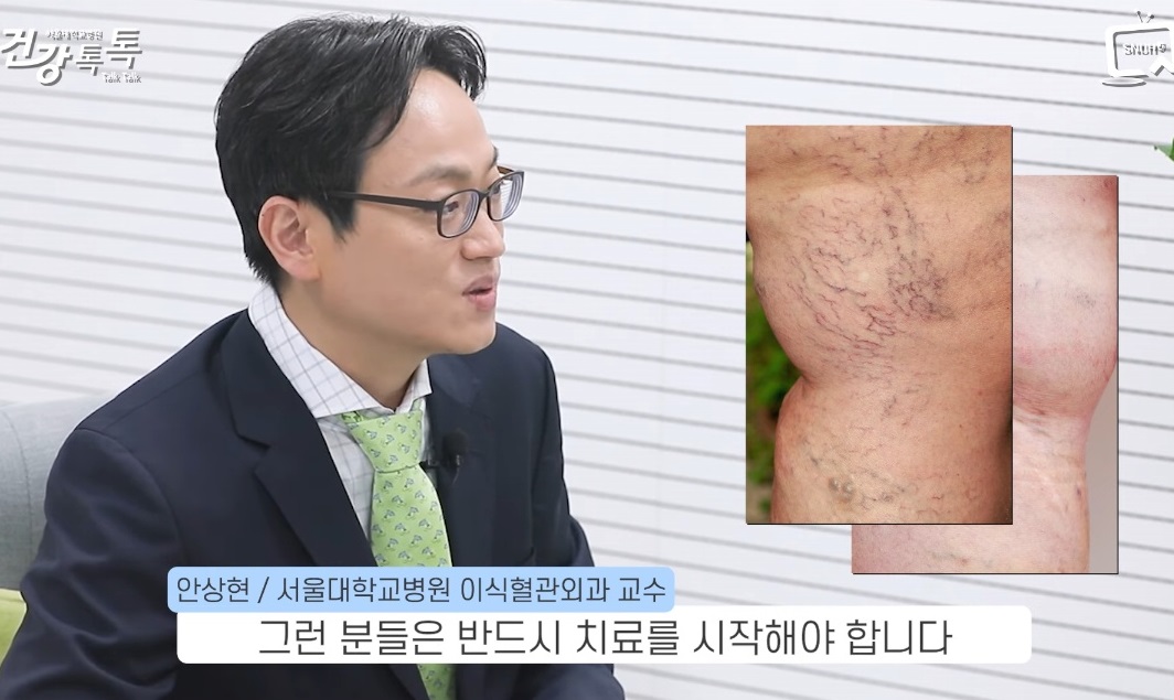 혈관외과-하지정맥류-다리-혈관-질환