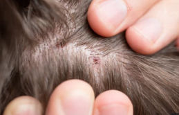 지루성 두피염 증상1