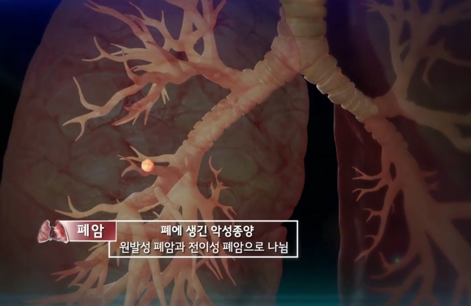 EBS명의-폐명의