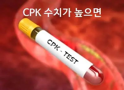 CPK 수치가 높으면